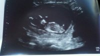 Baby.jpg
