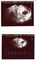Ultrasound 07142011.jpg