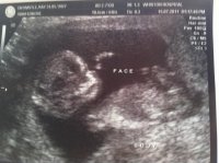 baby 15.07.11.jpg