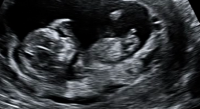 vlcsnap-2011-06-09-13h17m01s196.png