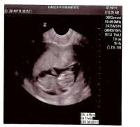 11 weeks.jpg