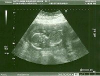 19wk2.jpg
