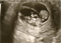 baby A 11wk waving.jpg