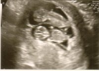 twins 11 wks pic1.jpg