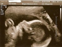 Grace27wks3edit.jpg