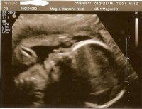 Grace27wks4edit.jpg