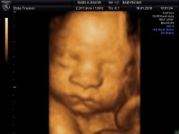 BABYBOND_19.jpg