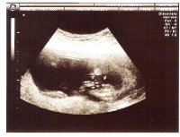 15w2dSonogram.Boy.jpg