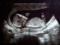 Baby edit.jpg