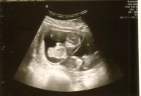 twins 12 wk 3d pic1.jpg