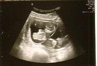 twins 12 wk 3d pic1.jpg