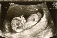 baby A 12wk3d pic1.jpg