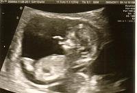 baby B 12wk3d pic1.jpg