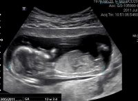 ultrasound.jpg