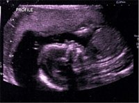 LittleJack_20-1.jpg