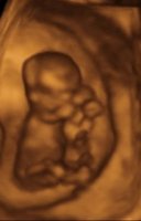 baby08-732881.jpg