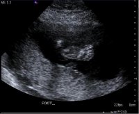 18 Weeks, Little Foot.jpg