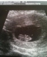 our baby.jpg