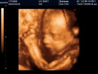 UC BABY_100.jpg