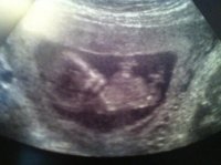 1st scan pic.jpg