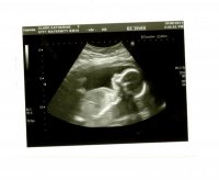 Scan@20+6b.jpg