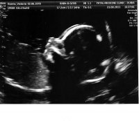 little pickle 21 weeks - 4.jpg