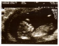 12weeks1.jpg