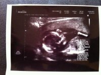 16w5d pic.jpg