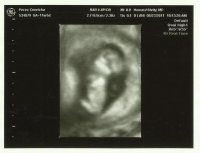 12weekultrasound.jpg