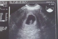 ultrasound.jpg