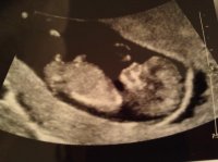12wk2.jpg