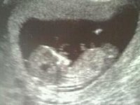 baby 2.jpg