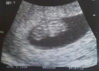 ultrasound1.jpg