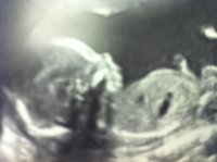 Baby E 03.jpg