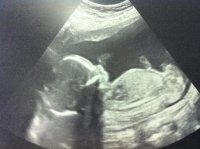 Baby E 01.jpg
