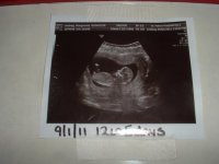 12w5d untrasound5.jpg