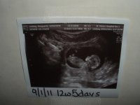 12w5d untrasound3.jpg