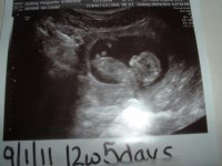 12w5d untrasound8.jpg