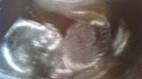 New baby scan 2.jpg