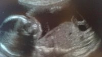 New baby scan.jpg