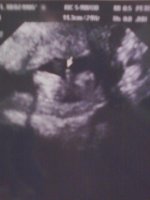 14Weeks4Days.jpg