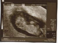 10w5d.jpg