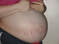 belly 33  nakie.jpg