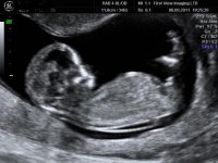 baby 9.jpg