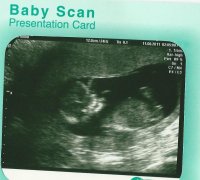 babyscan 2.jpg