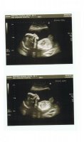 20 wk scan 2.jpg