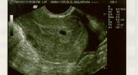 lilbean913.jpg