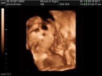 BABY GIRL CHEN_1.jpg