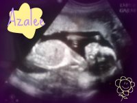 Azalee 20 weeks.jpg