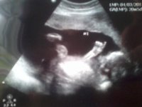 Ultrasound 20weeks 01.jpg